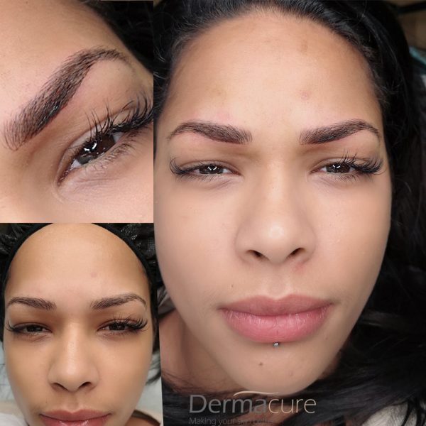 Microblading, Microblading Eyebrows, London - Dermacure